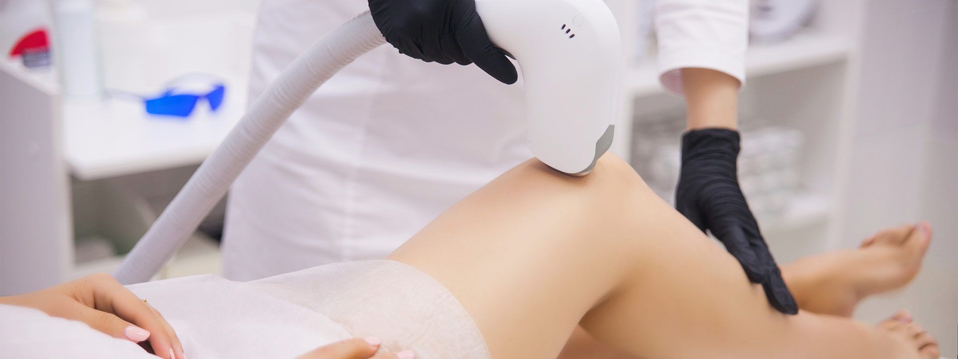 ND:YAG Lazer Epilasyon